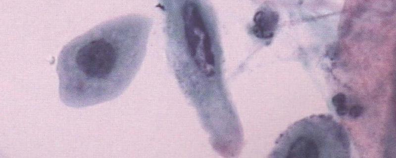 放线菌的繁殖方式，放线菌是原核生物吗
